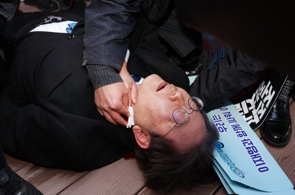 South Korean opposition party leader Lee Jae-myung is attended to after being attacked in Busan, South Korea, Jan. 2, 2024. (AFP Photo)