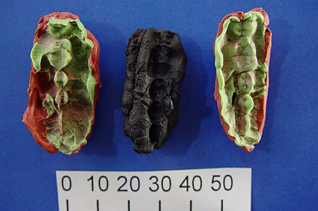 This undated handout picture released on Jan.23, 2024, by Stockholm University shows two casts and an original prehistoric chewing gum discovered in the Huseby Klev, Western Coast of Sweden. (AFP Photo via Verner Alexandersen/Stockholm University)