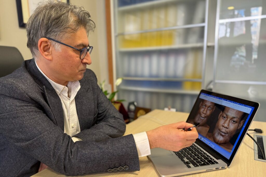 Dr. Ozan Seymen Sezen analyzing Yamayong's benign tumor, Istanbul, Türkiye, Jan. 31, 2024. (AA Photo)
