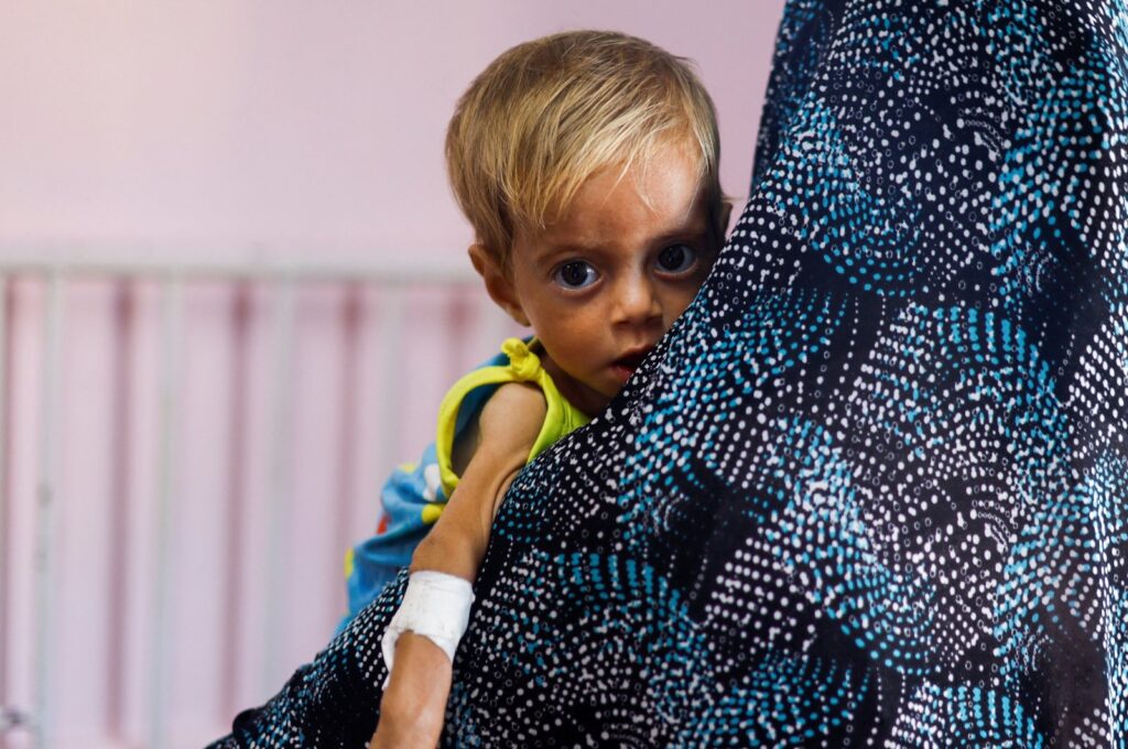 A Palestinian child looks on at Nasser Hospital in Khan Younis, in the southern Gaza Strip, Palestine, July 8, 2024. (Reuters Photo)