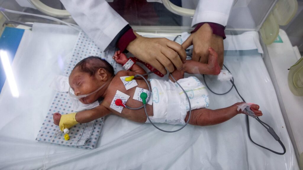 A prematurely-born infant receives care while lying in an incubator at the neonatal intensive care unit (NICU) at the Patient Friend's Benevolent Society hospital in Gaza City, Feb. 25, 2025. (AFP Photo)