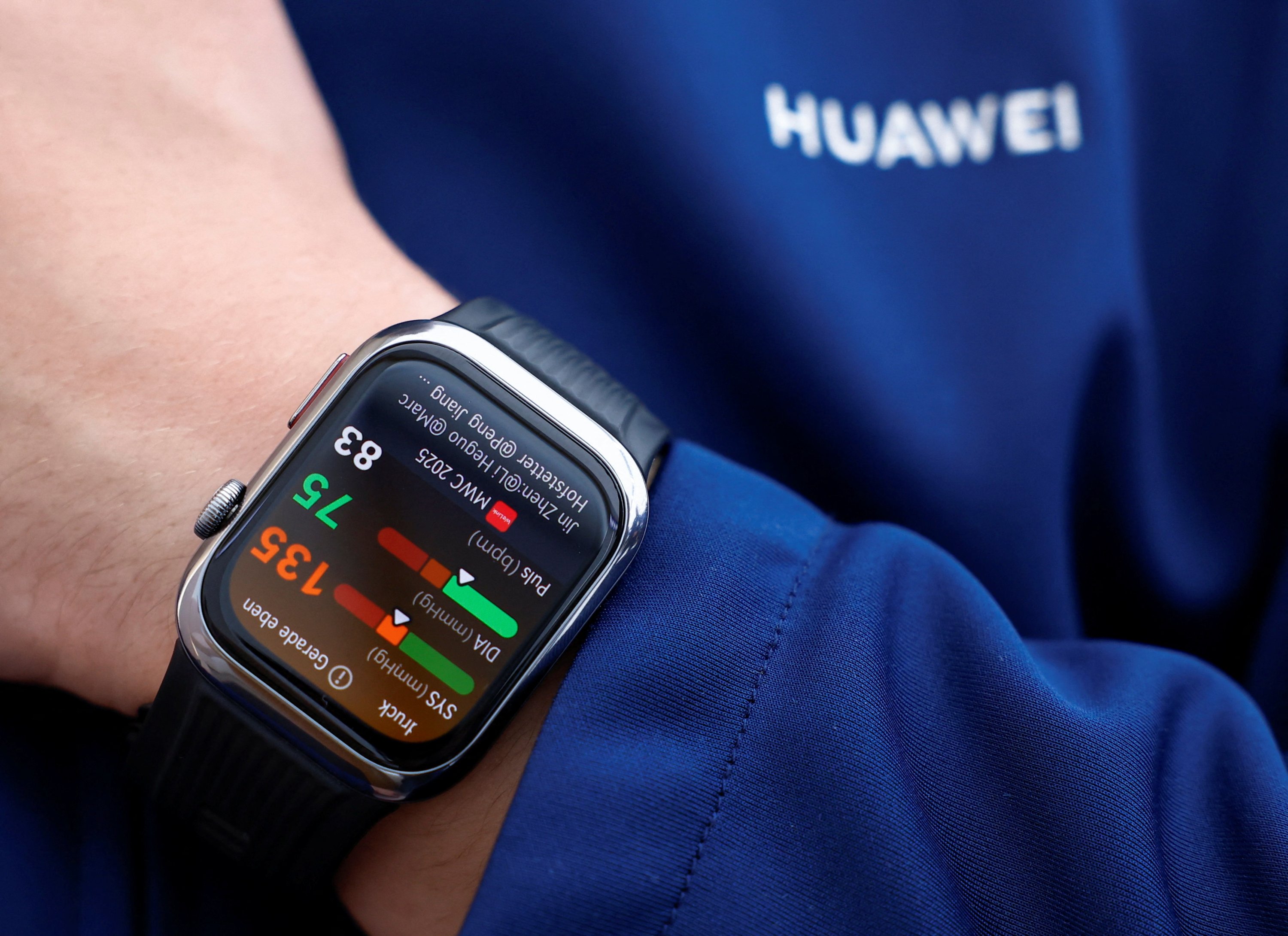 371917 A Huawei Watch D2 measures blood pressure while being showcased during the Mobile World Congress (MWC) trade show, Barcelona, Spain, March 3, 2025. (Reuters Photo)