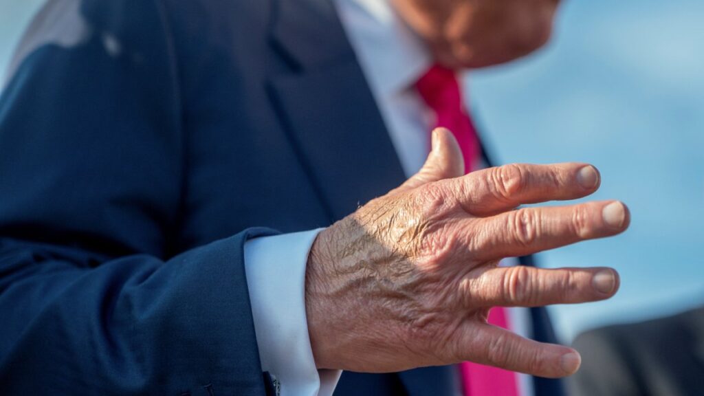 Make-up partially covers the back of the right hand of U.S. President Donald Trump as he speaks to members of the media upon his arrival from Pennsylvania, at Joint Base Andrews, Maryland, U.S., July 15, 2025. (Reuters Photo)